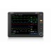 Мониторы пациента uMEC10